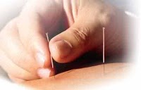 Healing Energy Acupuncture 727219 Image 0